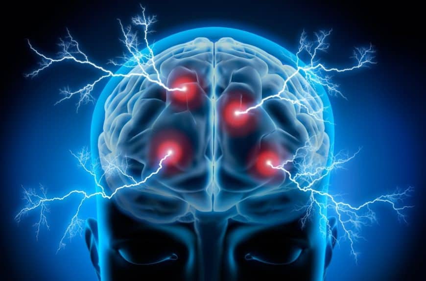 Epilepsy Brain Activity
